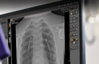 Carestream Presents Image Suite MR 10 Software to Boost the Imaging Experience for CR and DR Imaging Systems