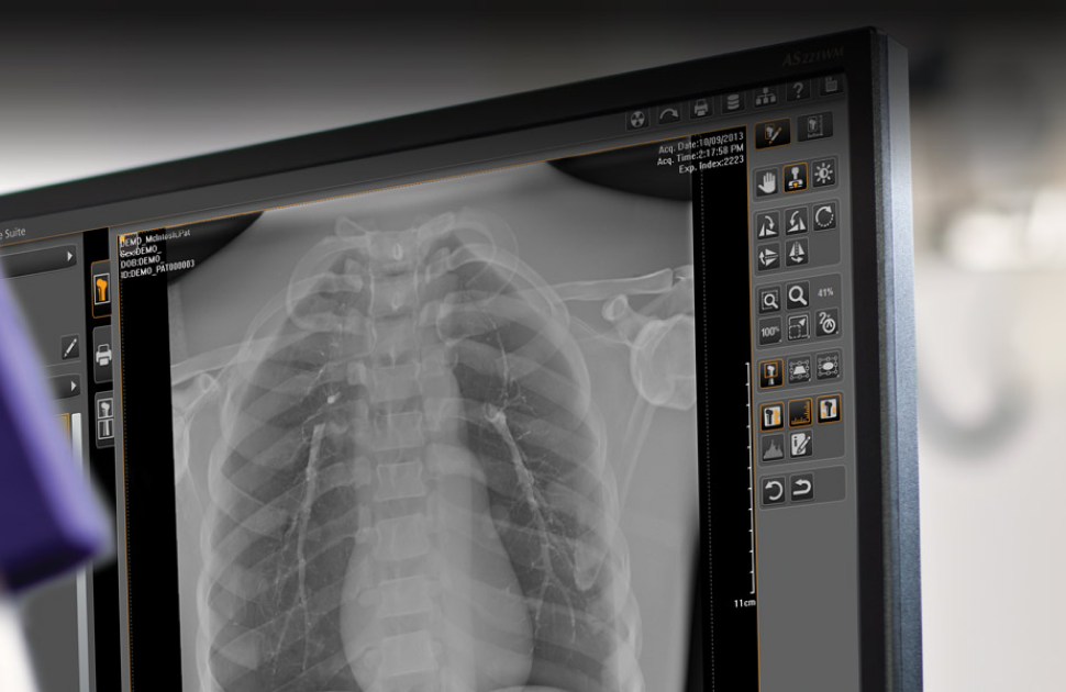 Carestream Presents Image Suite MR 10 Software to Boost the Imaging Experience for CR and DR Imaging Systems