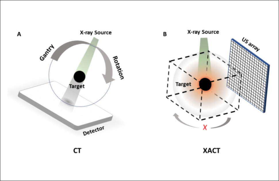 UCI Researchers Achieve 3D CT Imaging Innovation