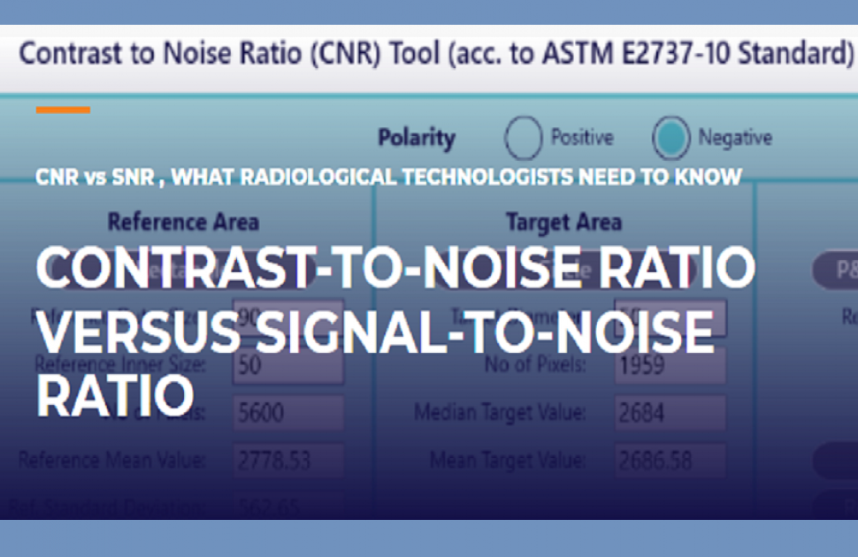 CNR VS SNR , WHAT RADIOLOGICAL TECHNOLOGISTS NEED TO KNOW